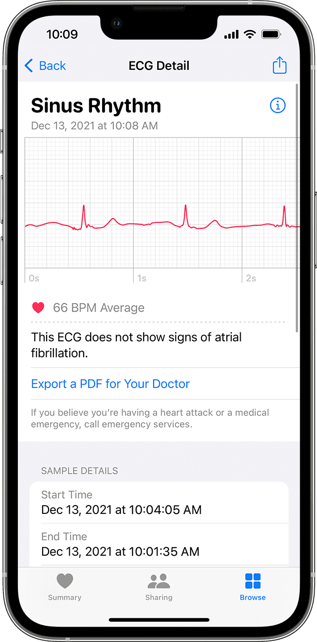 Mit der EKG-App auf der Apple Watch ein EKG aufzeichnen - Apple Support (DE)