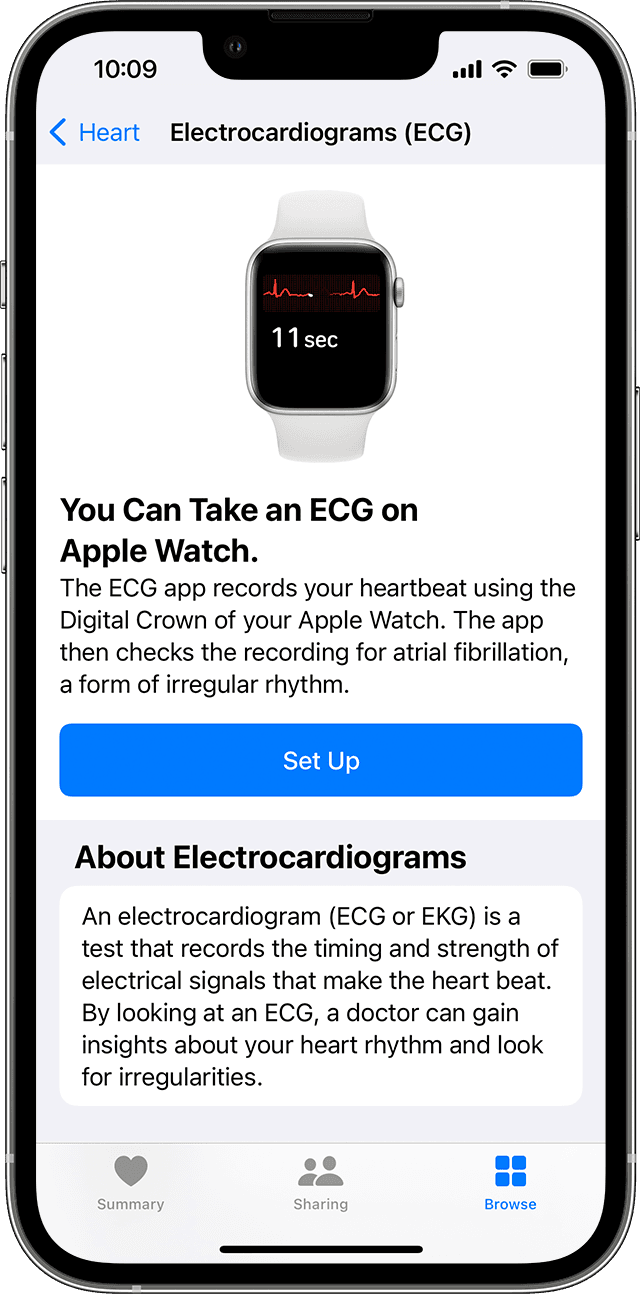 Tracciare un ECG con l'app ECG su Apple Watch - Supporto Apple (IT)