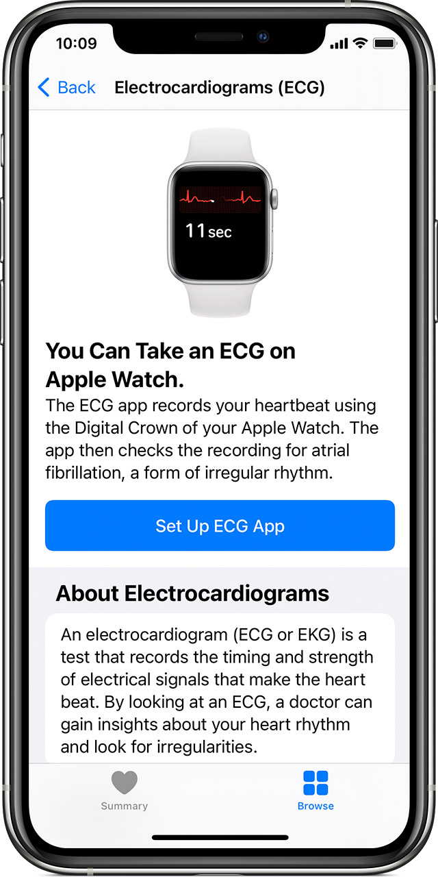 apple watch series ecg