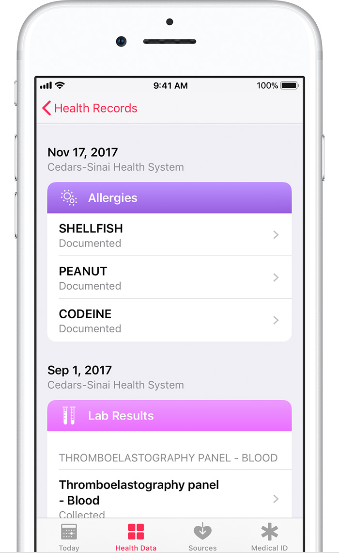 View health records on your iPhone or iPod touch (beta) Apple Support