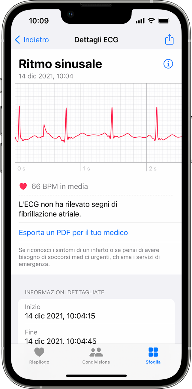 ecg apple watch 3