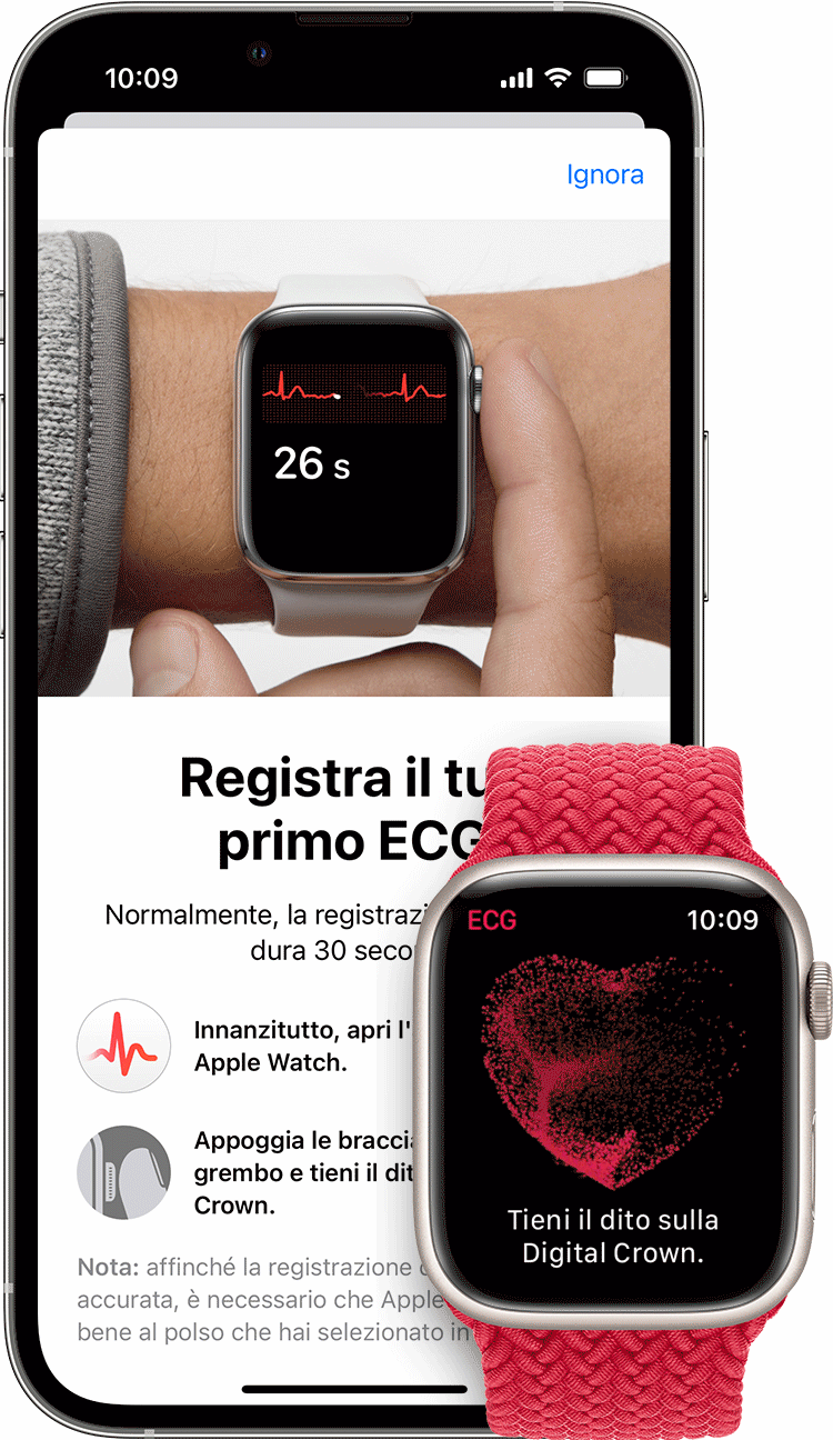 Ecg Reading App Ecg Apple Watch MÃ©xico Iphone Non Trovo App Ecg